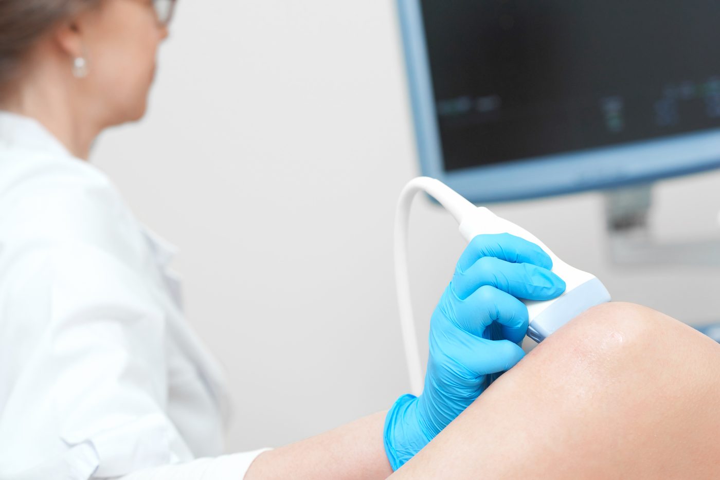 Exame de ultrassom vascular na perna